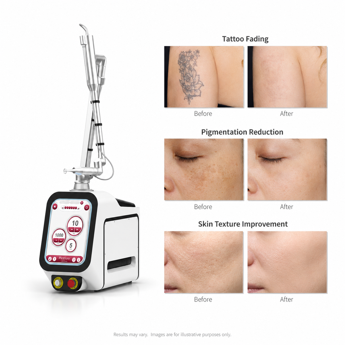 Portable Picosecond Laser System – Advanced Tattoo, Pigment & Skin Rejuvenation Device